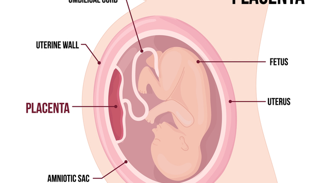 anterior placenta